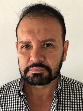 HUGO FERNEY LEONEL